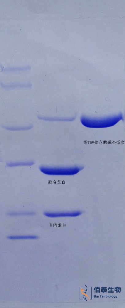 煙草蝕紋病毒蛋白酶